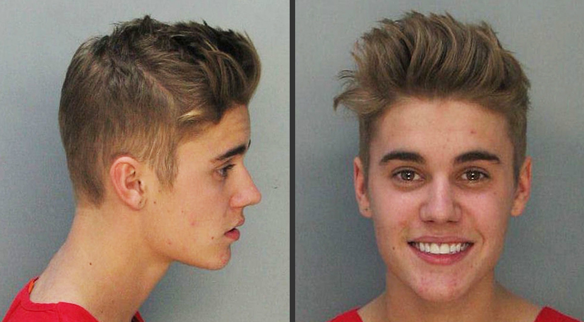 Prison ‘breakout’ Explaining Justin Bieber’s acne in his mug shot